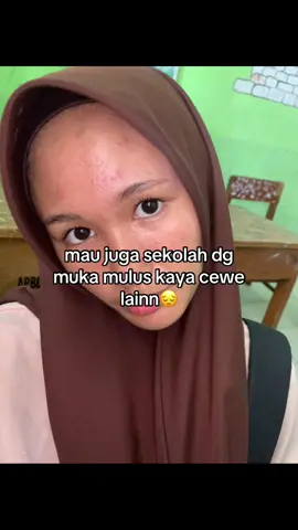 Sediii☹️#fyp #acnefighter 