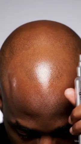 tag someone who need this hair growth spray  #asmr #satisfyingvideos #hair #curly #hairstyle 