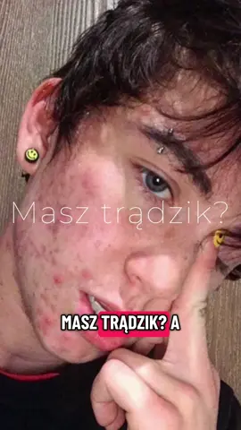 Masz trądzik? To przestań robić tę jedną rzecz Twoja skóra nie potrzebuje 10 kremów. Potrzebuje prostoty i spokoju. Jeśli masz dość błądzenia i chcesz w końcu zobaczyć efekty — 👉 w moim e-booku znajdziesz plan krok po kroku Link w bio. #tradzik #tradziktwarzowy #skincareminimalism #tradziktiktok #clearskinjourney #zdrowaskora #acnetips #acnepoland #pielęgnacjatwarzy #skincaretok #naturalbeauty