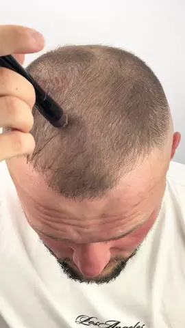 THICK FIBER Root Touch Up ✨ Instantly cover greys & thinning spots, with a precision brush for easy, natural-looking coverage. Water & sweat resistant. Perfect for women & men. #RootTouchUp #ThickFiber #hairlinepowder #rootcoverup #haircolorroottouchup 