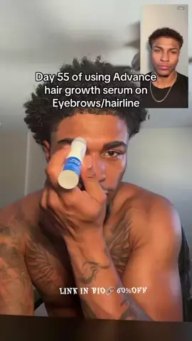 Eyebrows and hairline got so much thicker #eyebrowsonfleek #eyebrows #eyebrowgrowth #eyelashes #hair 