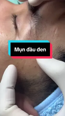 Xem xong rồi đi ngủ nè các tình iu 😊#spauytinvungtau #winspavungtau #nanmun 