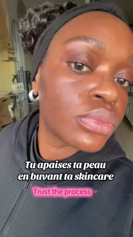✨ Recette skincare & digestion ✨ Parce que prendre soin de sa peau, ça passe aussi par l’intérieur 💕 👉 Ma petite boisson du moment : • 75 ml d’eau • Jus de 3 citrons 🍋 • 2 càs de curcuma  • 3 càs de graines de chia 🌱 • 2 càs de miel 🍯 💧 Les bienfaits : 🌟 Répare et protège la barrière cutanée 🌟 Favorise une meilleure digestion 🌟 Réduit les ballonnements 🌟 Booste l’éclat de la peau Une boisson simple, efficace, et surtout délicieuse 😍 #skincaretip #boistaskincare #evolution #beautyhack #TikTokBeauty 