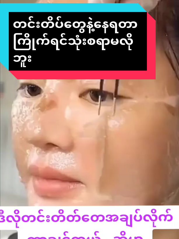 uzumakigod18#ဘာသုံးသုံးတင်းတိပ်မပျောက်သူအတွက် #တင်းတိပ်အမဲစက်အမာရွတ်ပျောက်ချင်မှသုံး #viber09458460617 #တလစာ၃ထုပ်ဘဲသုံး #မပျောက်ရင်ငွေပြန်အမ်းမယ် @မလဲ့💙 