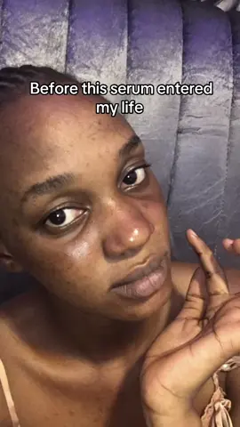 Fade dark spots, melasma, and uneven tone with the Lab in Nature Niacinamide Serum from Skin1004 🌿 Powered by 10% niacinamide + centella, it brightens dull skin while keeping your barrier calm and hydrated. #skin1004 #darkspots #hyperpigmentation #goviral #brighteningserum 