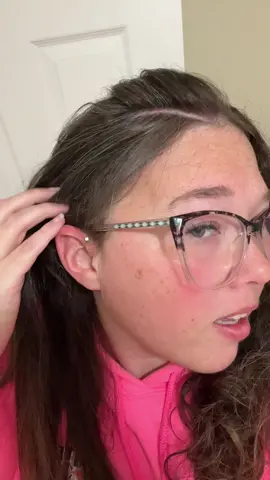 Craniotomy Scar #scar #fyp #brainsurgery #survivor 