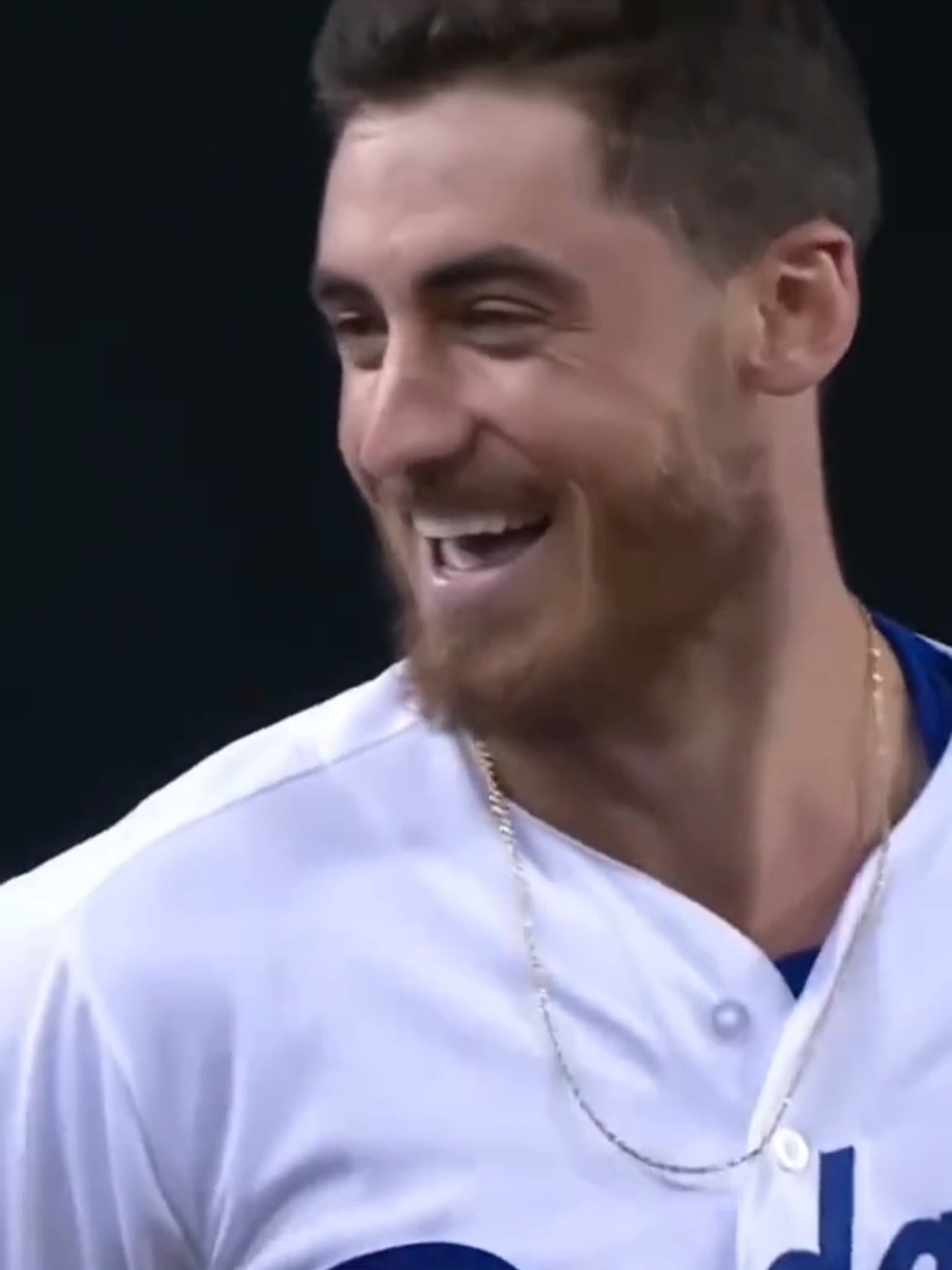 #shorts #basseball #mlbb #beisbol