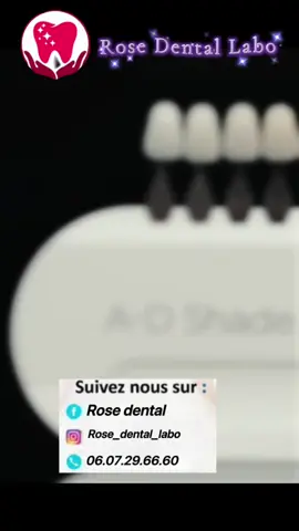 #prothesistedentaire #zirconiacrown #teinter #لليكاتكم_تهمني_وتعليقكم_آهم 