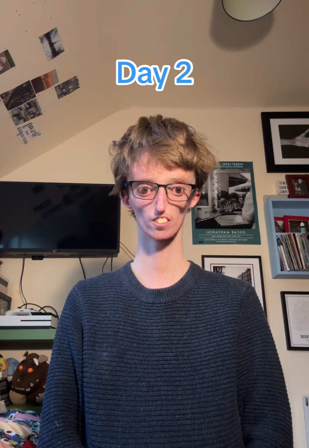 100 Miles Walking Challenge for @Changing Faces UK 💙 Changing faces deserve something back after all the work they do by supporting so many people with visible differences and disabilities. 💙 If you have a passion for something, go for it , don’t let nothing hold you back! 💙 #fyp #getviral #changingfaces  #disability #sharethis 