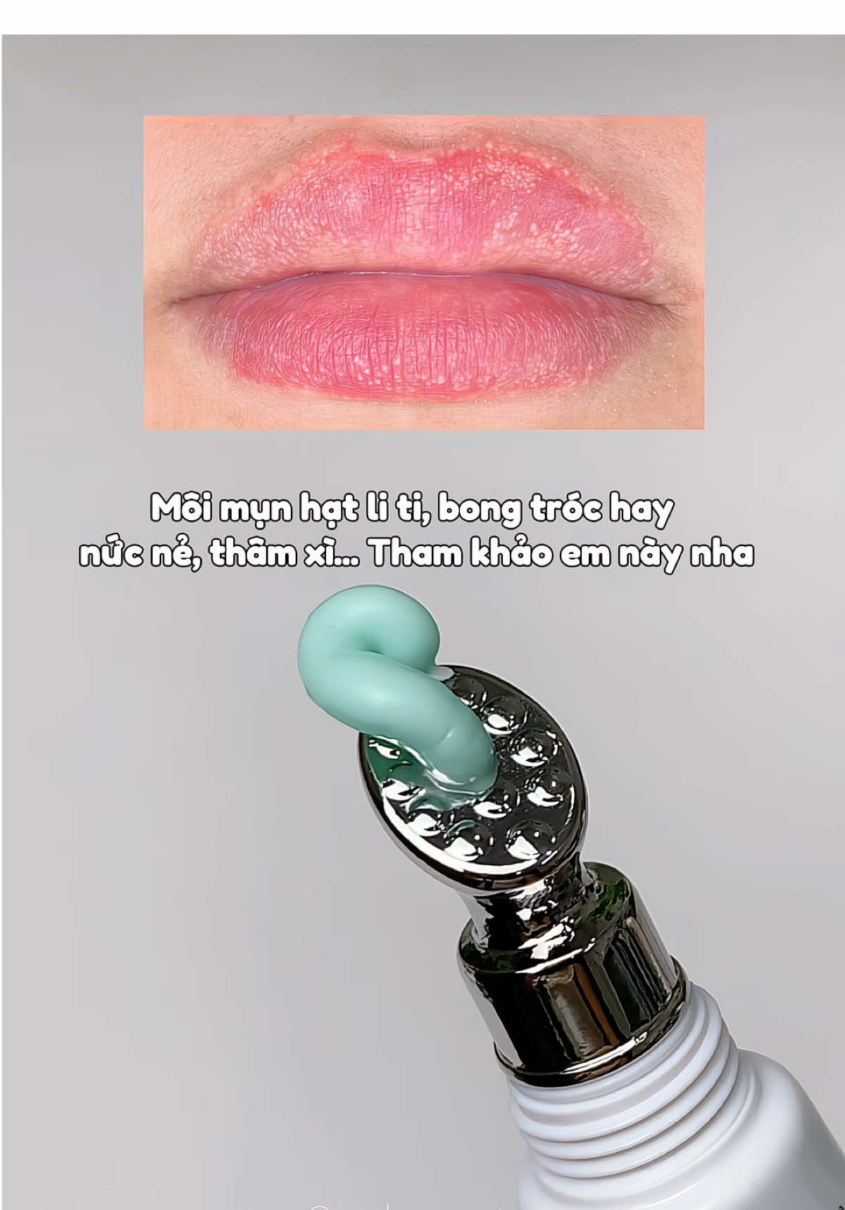 Tậu ngay em này liền nha ✨ Kem mụn môi ABERA FORDYCE #kemmunmoi #kemthammoiabera #abera #mockyan 