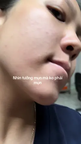 Bế tắc khi tìm nguyên nhân. Ko biết vì sao như này#skincare #skincareroutine #chamsocda #xuhuong #fyp 