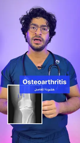 خشونة المفاصل وحمايتها #doctor #medicine #health #