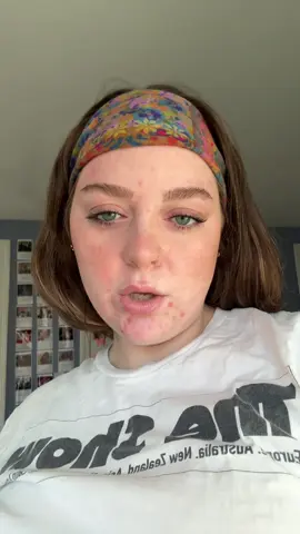 (desperately😃) trying to become more comfortable with not covering up my acne because social media sucks and the “perfect” skin you see on this app is usually fake ❤️❤️‍🩹 #foryoupage #acneproneskin #acnescars #tretinoinjourney 