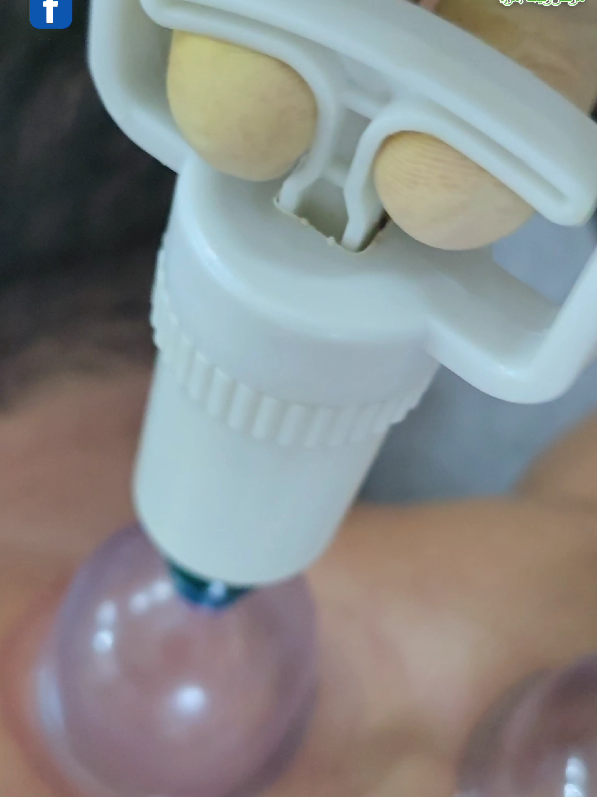 ما هو الفرق بين دم الحجامة ودم التبرع؟ #العراق #الشعب_الصيني_ماله_حل😂😂 #ترند #اكسبلور #السعودية 