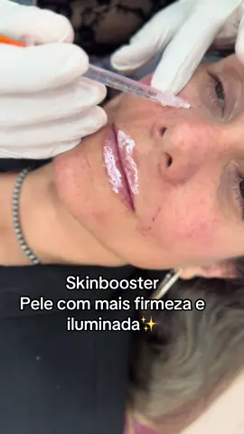 Skinbooster DMAE + NCTC  #harmonizacaofacial #EstéticaFacial  
