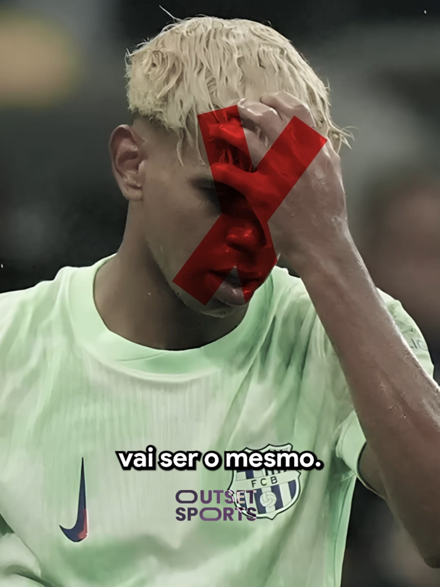 UM MEDICO disse que o Yamal NUNCA MAIS vai ser o MESMO. #lamineyamal #barcelona #messi