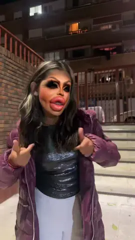 Cuando el filtro se pasa de realismo 😂💋 #FiltroLocura #TikTokFun #ParaTi #ComedyTren