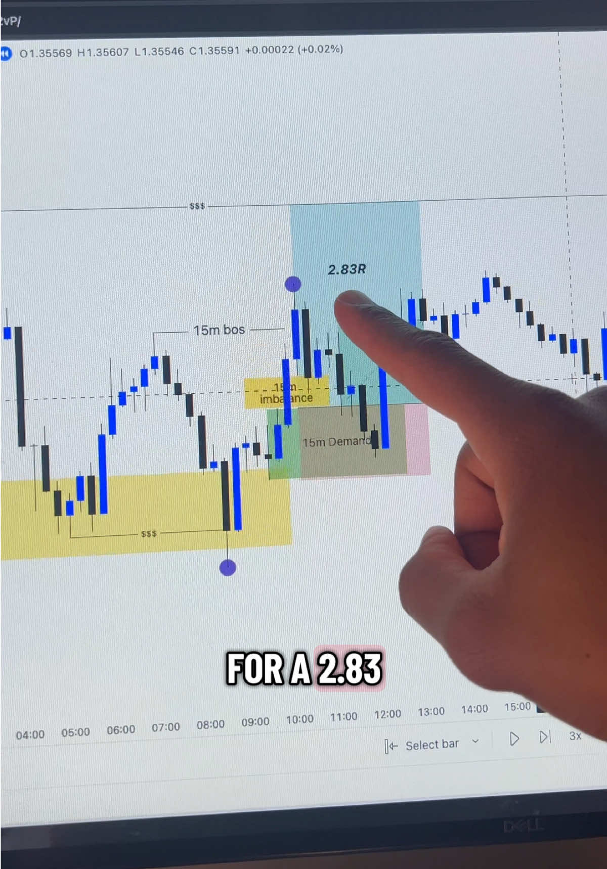 Daytrading #daytrading #fyp 