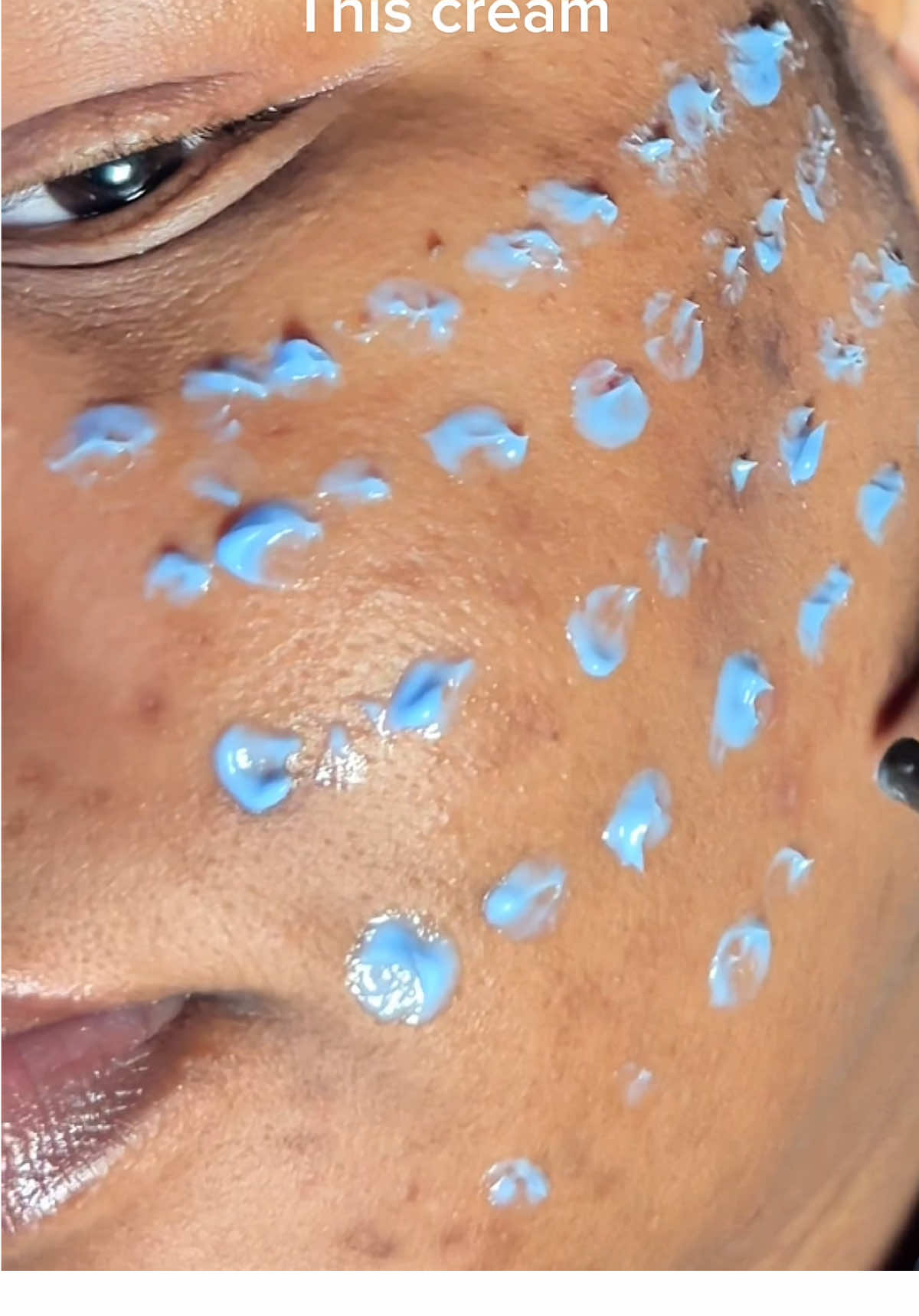 Manchas oscuras ?? @SAM'U Store US  #spotcream #samu #phsensitivecream #kbeauty 