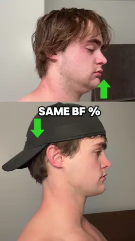 In shape, but have a fat puffy face? #fyp#looksmax