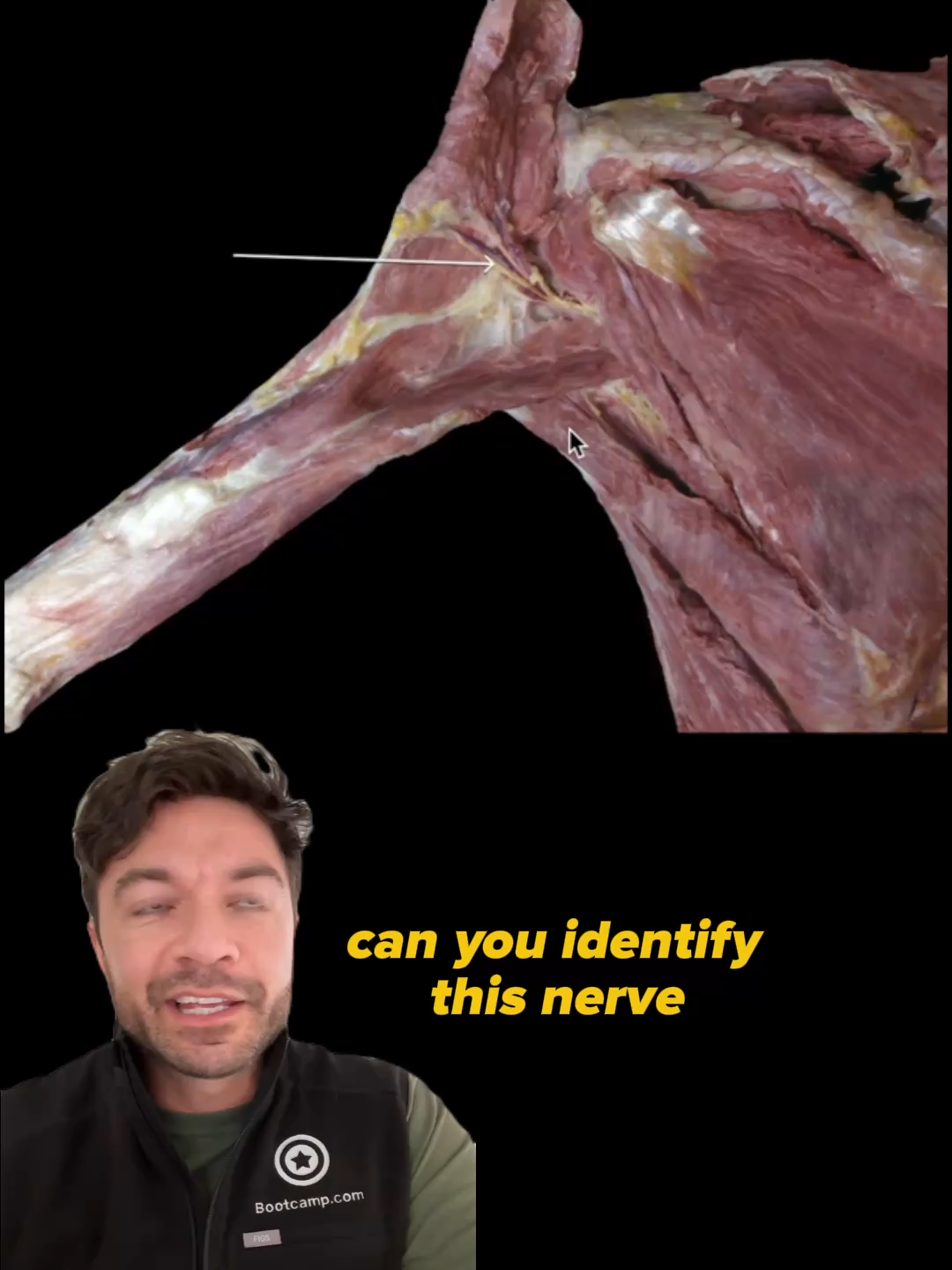 Can you identify the structure? Post your answers in the comment section #medschool #medschoolmemes #medschoollife #medstudent #medstudentlife #step1 #usmle #usmlestep1 #anatomy #greysanatomy