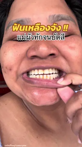 บัดสีหนัด!! แม่ผัวทักฟันเหลือง #ยาสีฟันขิงขิง #รีวิวบิวตี้ #ป้ายยาบิวตี้ #ใช้ดีบอกต่อ 