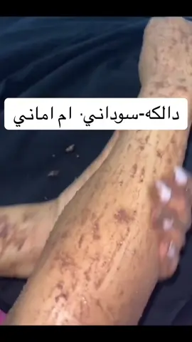 #دلكة_سودانية #شيل_حلاوه_جسم_لرياض #fyppppppppppppppppppppppp #explore #كسبلور_explor 