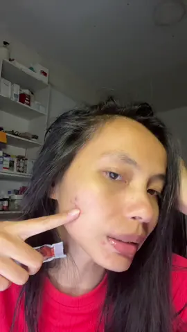 #zinc. #zincmedita. #zincgluconate   #zincgluconate75mg   #ซิงลดสิว       