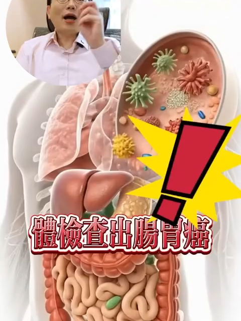 【江坤俊醫師推薦】【美國進口EGUOO消化酶腸胃片】 美國諾貝爾獎得主推薦！ 每天一粒，有效改善消化不良，經常便秘，胃食道逆流！ 👍胃難受的吃它！胃裡有氣頻繁打嗝噯氣的吃它！ 嘴巴難聞臭烘烘的吃它！反酸水燒喉嚨的吃它！ 👍它每一片都含有10餘種的消化酶。三種腸道益生元，五種植物提取的精華 ✅有效改善消化不良，經常便秘，胃食道逆流