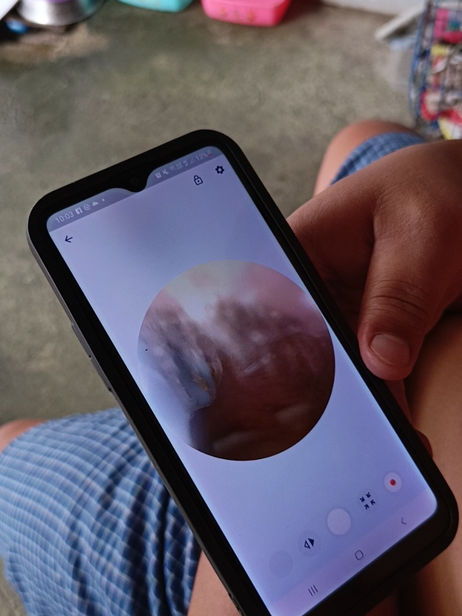 panlinis ng tenga with light & camera #earwaxremoval #earpick #fyppppppppppppppppppppppp 