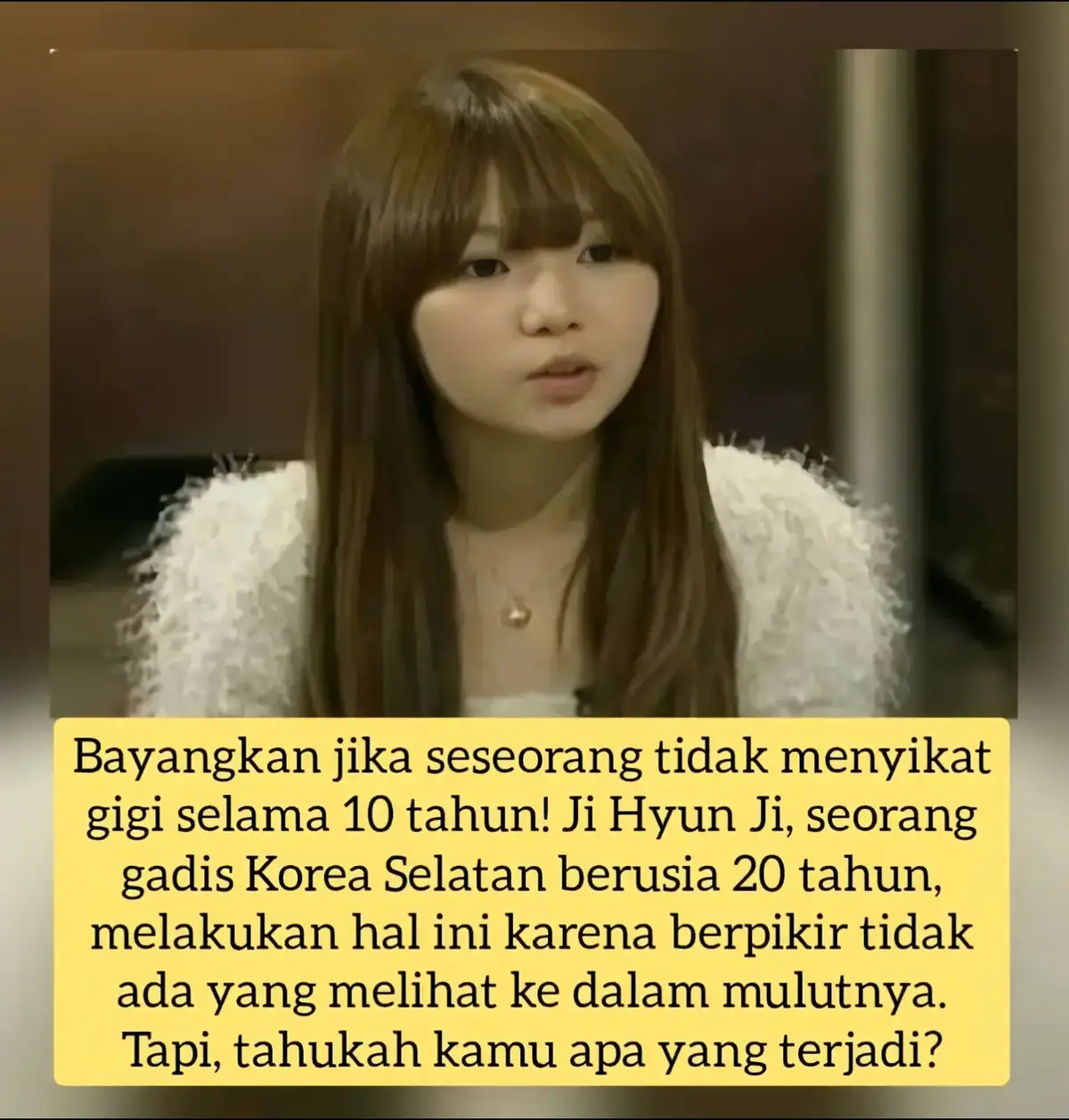 Setiap orang terkadang memiliki kebiasaan khusus yang tidak dimiliki orang lain. Tapi di Seoul, Korea Selatan seorang gadis mengaku tidak pernah menggosok gigi selama 10 tahun. Dalam sebuah program TV Martian Virus dari tvN Seoul memperkenalkan seorang gadis yang dikenal sebagai 'Cutey Yellowish'. Julukan ini diberikan karena ia berhenti menggosok gigi satu dekade lalu. Ia mengungkapkan bahwa terakhir kali ia ingat melakukannya adalah ketika sang ibu menggosokkan gigi untuknya. 