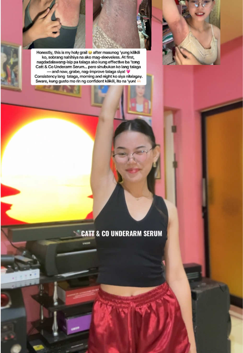 Honestly, this is my holy grail 😭 after masunog ‘yung kilikili ko, sobrang nahiyang ako mag-sleeveless. At first, nagdadalawang-isip pa talaga ako kung effective ba ‘tong Catt & Co Underarm Serum… pero sinubukan ko lang talaga — and now, grabe, nag-improve talaga siya! 💖 Consistency lang pala talaga, morning and night ko siya nilalagay. Promise, kung gusto mo rin ng confident kilikili, ito na ‘yun! 🫶🏻 #CattAndCo #underarmwhitening  #cattandco #underarmserum #kilikilicare 