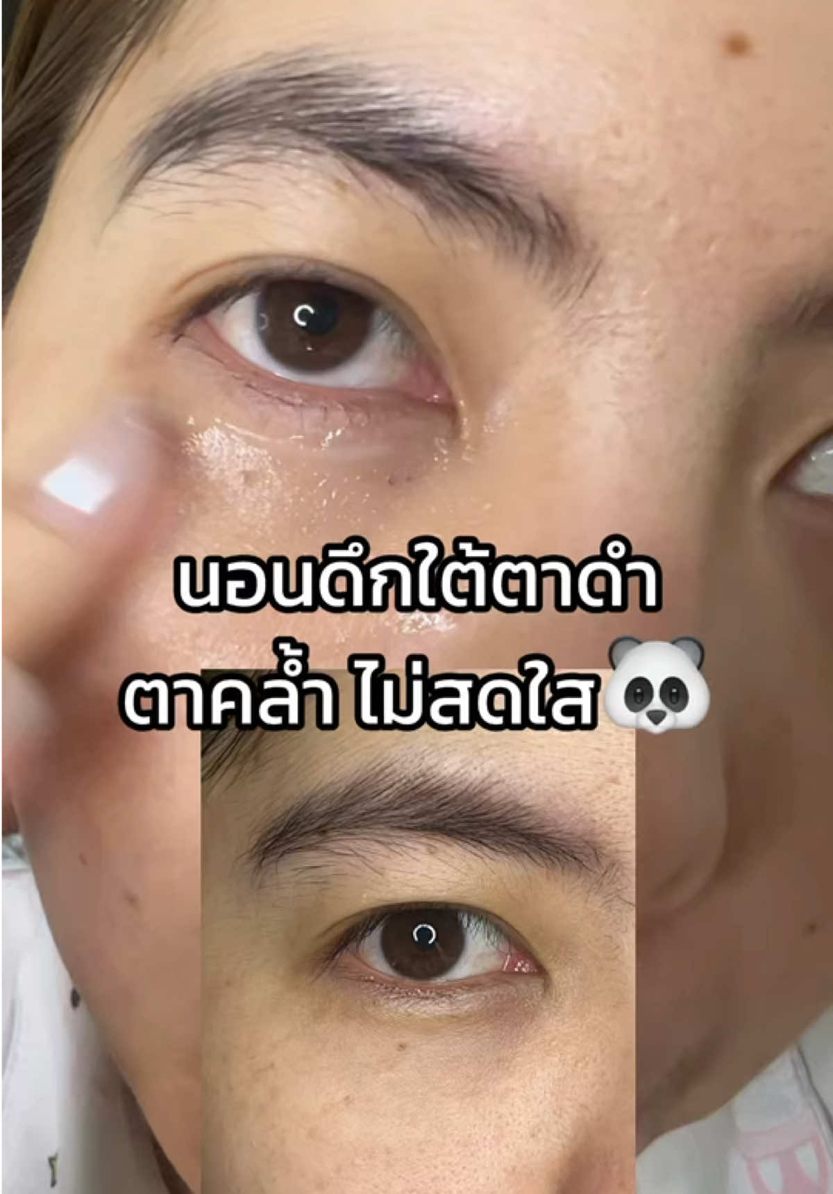 นอนดึกใต้ดำ ตาคล้ำ ไม่สดใส 🐼 ต้องใช้จุลินทรีย์ 5D เปปไทด์ อายครีม PAPA FEEL ตัวนี้เลยค่ะ👀✨ #papafeel #papafeelth #papafeel5dpeptide #5dpeptide #อายครีมจากจุลินทรีย์ @PAPAFEEL @PAPA FEEL Offcial store 