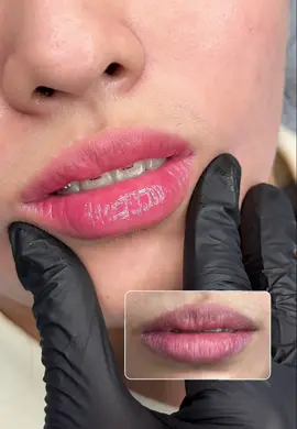 Chiếc M.O.I tròn 2 tháng tuổi 😍#hutdungdich #khuthammoi #phunmoisoftlips #phunmoitunhien #phunmoidep 