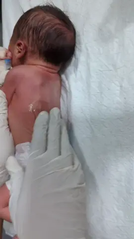 CUTE BABY – GENTLE OIL MASSAGE TIME Sweet baby enjoys a warm oil massage that relaxes the body, strengthens muscles, and improves blood flow. A perfect moment of care and love. 👶💆💖 #CuteBaby #OilMassage #BabyCare #HealthyGrowth #Educational 