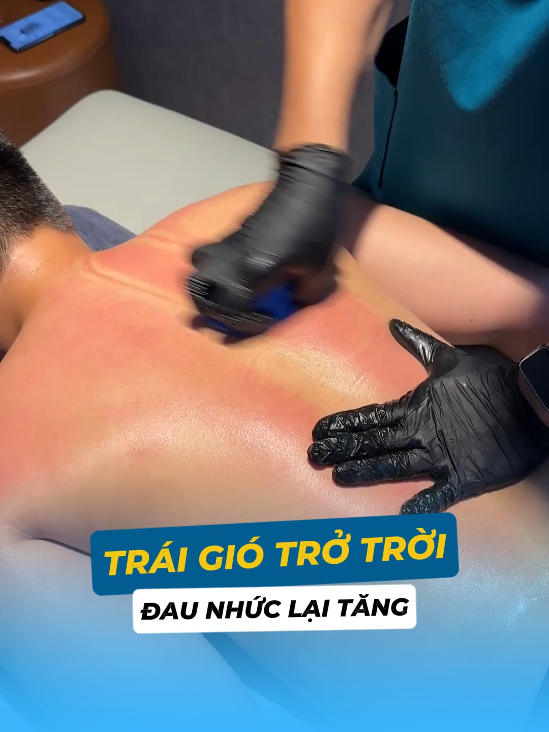 Căng cơ do trái gió trở trời #lykos #stretching #coxuongkhop