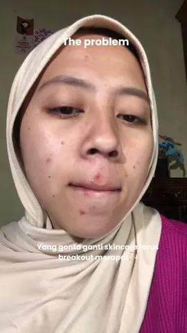 The real hidden gem udah ada semua di moisturizer ini #MSGlowBeauty #blackdiamondmoisturizer #MBG #MoisturizerBikinGlowing #snailmoisturizer @msglow.beauty 