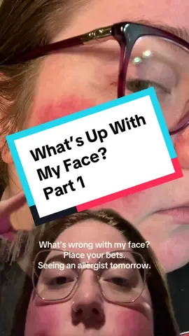 I have many years of documentation of these rashes since 2019. I have hEDS so they’ve been largely ignored due to my many other medical issues. It’s their turn tho! Hoping to get some relief as they’re very uncomfy when they flare up. #medicalmystery 
