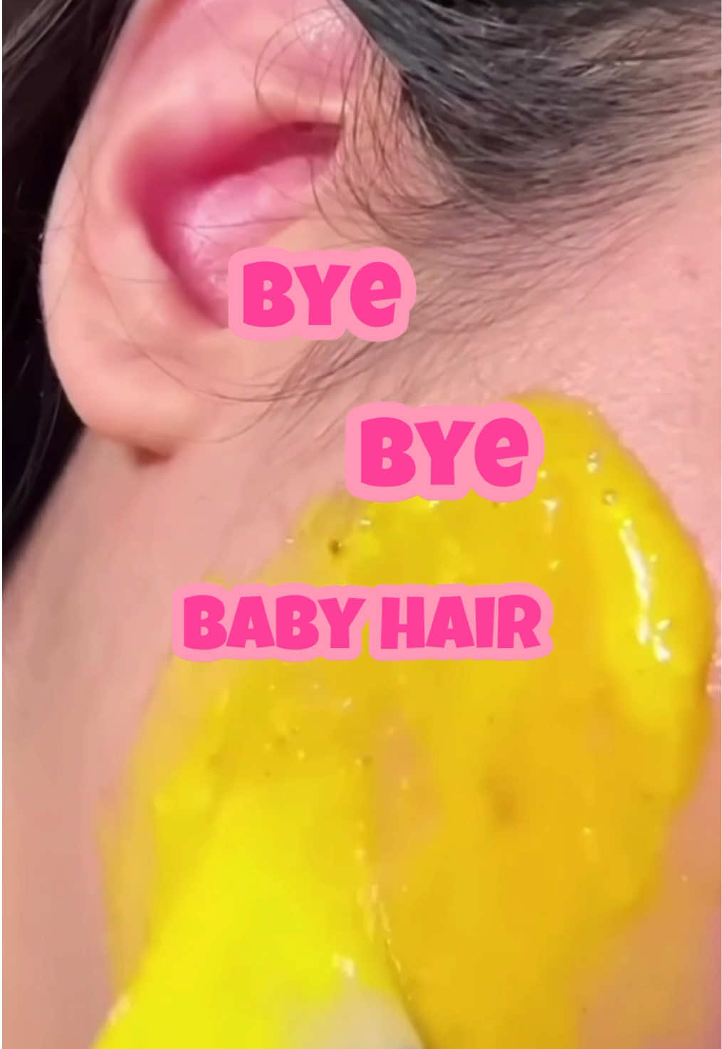 No more baby hair now. Try this remedy . 