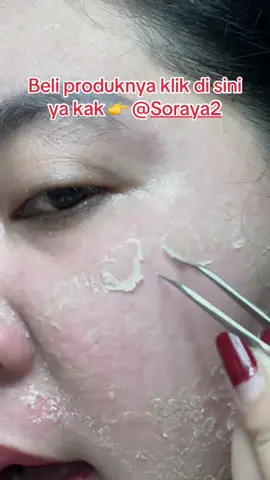 BELI PRODUK DAN KERANJANG KUNINGNYA KLIK DI SINI YA KAK 👉 @Soraya2 