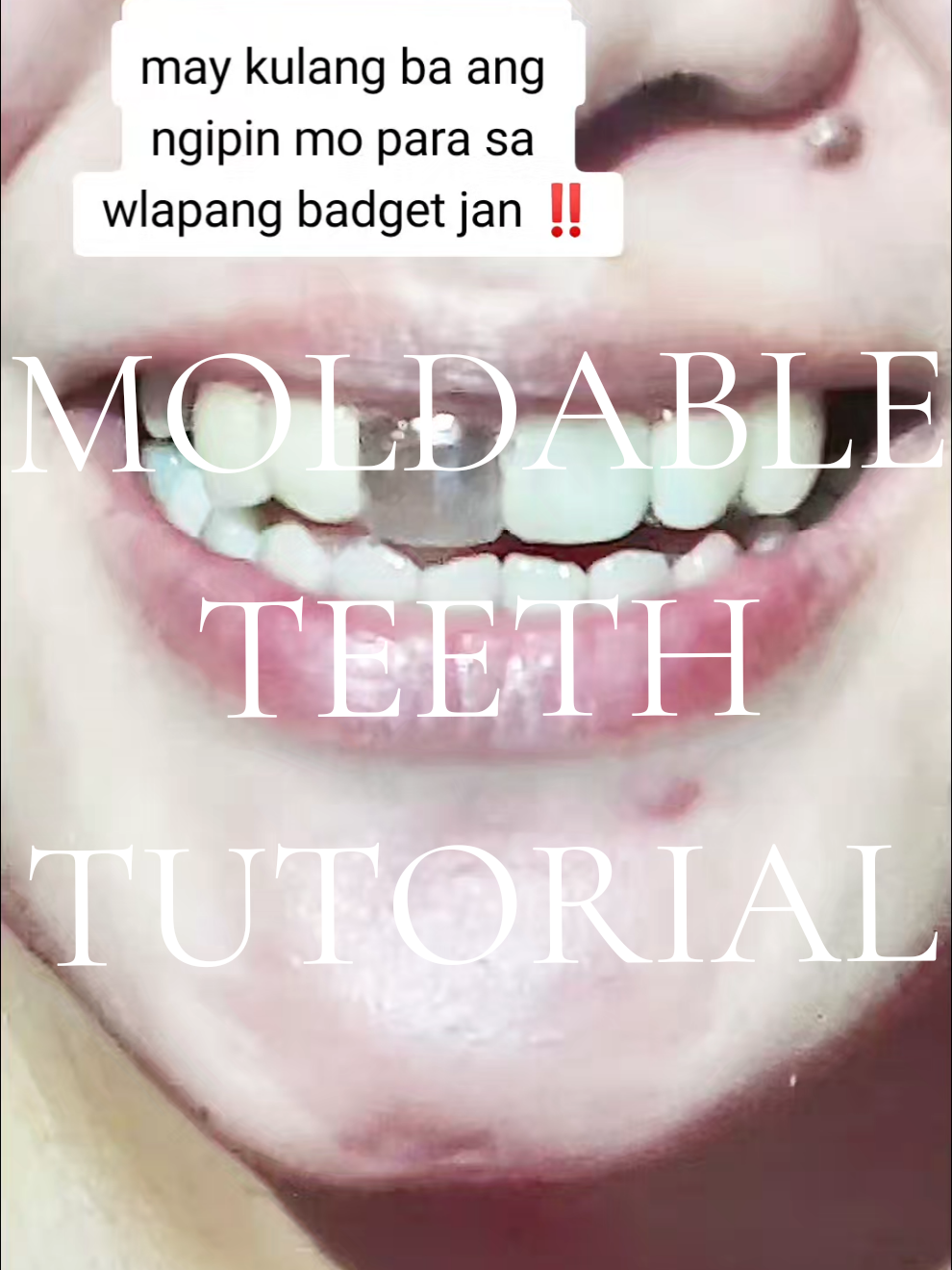 use temporary only.  #moldadablefalseteeth  #teethsilicone  #falseteethmoldable  #teethpustisoplastic  #moldablefalseteethtutorial 