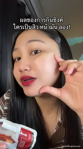 หน้ามันทอดไข่ได้ ลอง! #ซิงค์zinc #ซิงค์ลดสิว #ซิงค์เมดิต้า 