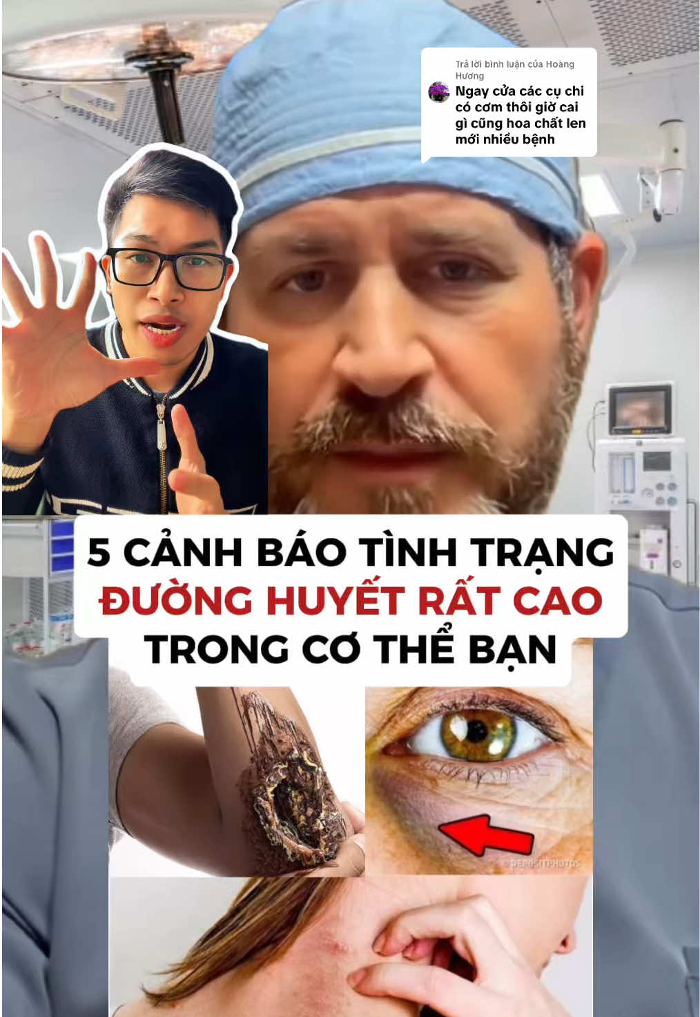 Trả lời @Hoàng Hương Các vấn đề về mãn tính không lây ngày càng nhiều: huyết áp, tim mạch, tiểu đường,… đến nay phần lớn là từ chất lượng thực phẩm ngày càng tệ. Vệ sinh an toàn thực phẩm kém, hàm lượng đường cao, tỉ lệ sử dụng thuốc ko chỉ định nhiều,… Hãy lưu ý 5 dấu hiệu này của cơ thể bạn nhé #glucose #tieuduong #roiloanchuyenhoa #duonghuyet #khanginsulin 