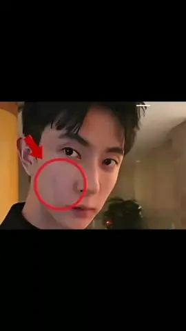 Postingan November 2024 wajah YML lelah dan penuh lebam di pipi.   yumenglong# Alanyu# studioyumenglong# eternallove# yumenglong# theelegedofwhitesnake# aktorchina# JusticeForYoumenglong# Ripyumenglong# RipBiance# #fyp #fyppppppppppppppppppppppppppppppppppppシ