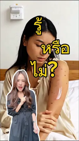 ผิวแพ้ง่ายต้องลอง! 🌿 สบู่พลูคาวสมุนไพรแท้ ดีท็อกซ์ผิว ลดผดผื่น คัน ได้จริง 💧 #สบู่สมุนไพร #ของดีบอกต่อ #ผิวแพ้ง่ายใช้ได้ #ขึ้นฟีดเถอะ #เปิดการมองเห็น 