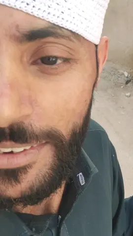 #sharethecare #viral #trendiingvideos #follower #follower 