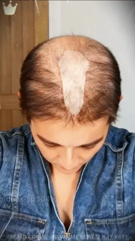 It's time to wash your hair, and this volumizing shampoo will encourage growth and prevent breakage and damage✨✨#hair#hairtok#hairstyle#haircut#tiktokshopfalldealsforyoudays#TikTokShopBlackFriday #TikTokShopCyberMonday