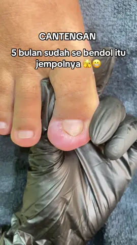 #cantengan #pedicuretime #cantengantanpacabutkuku #fyp #beautybarsby 