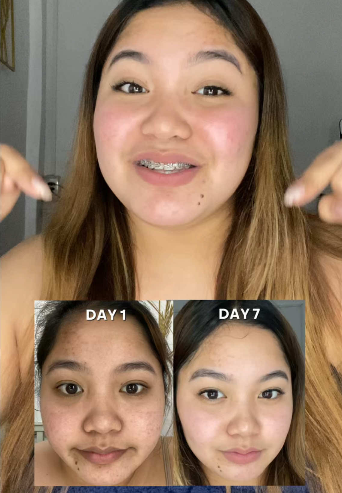 From dull to radiant in just a week. Love it🌸✨🧡