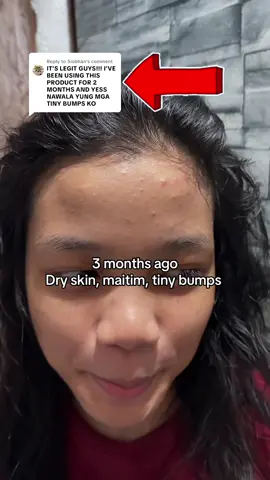 Replying to @Siobhàn Grabe, mas makinis pa sya sakin 😭 alagang hegerbaby 🫶🏻 #fyp #hegerbaby #momapproved #fypviralシviraltiktok #kidsessentials 